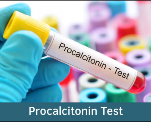 Procalcitonin