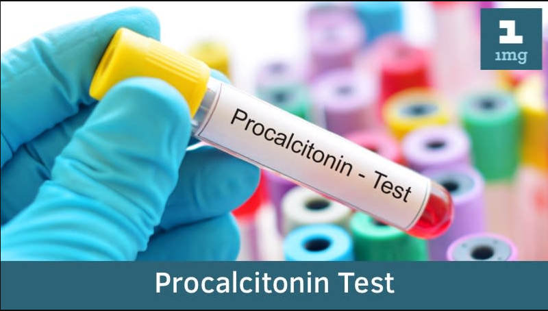 Procalcitonin